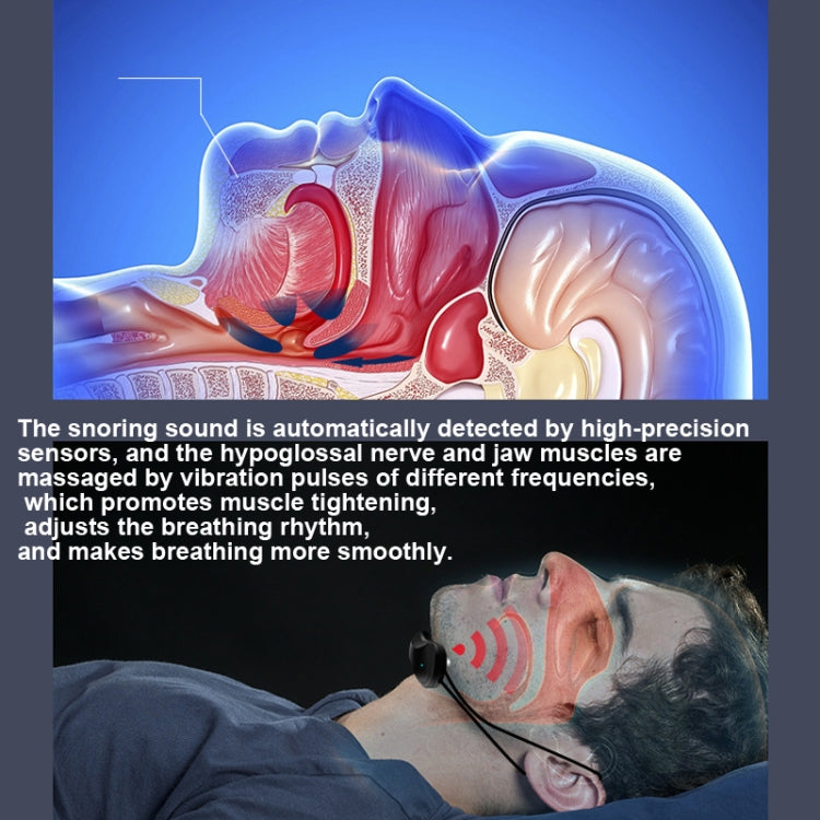 USB Rechargeable Smart Anti-snoring Device Home Snoring Corrector(Black) by bashfashion