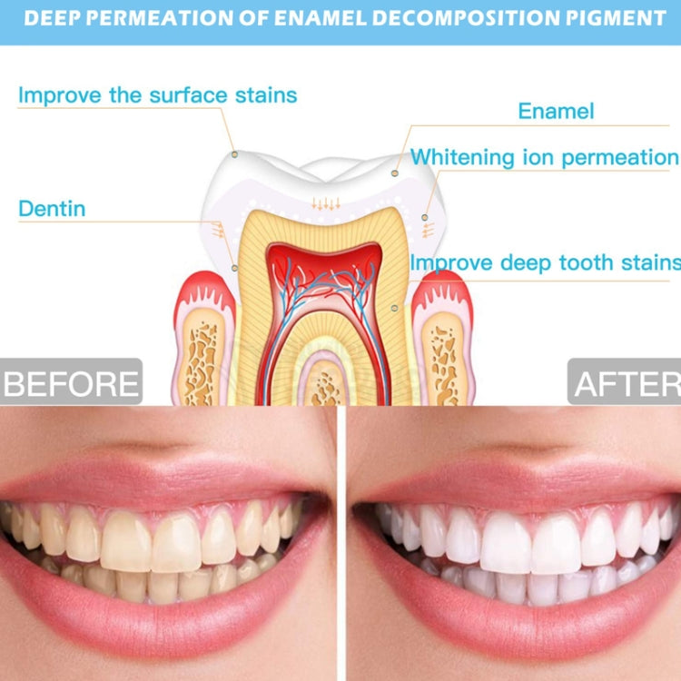 Wire-Controlled 25min Timing 16LED Teeth Whitening Device Dental Bleaching System(White) by bashfashion