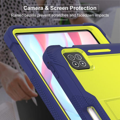 EDA005862204F_6.jpg@ea238b8f6d60a294fb3b12d87c9e0edd