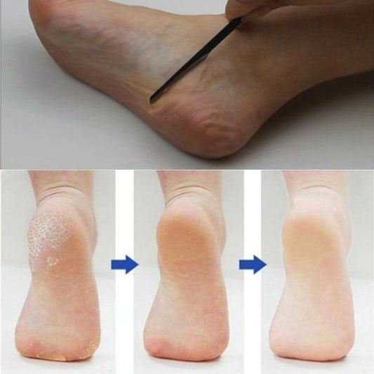 Pedicure Manicure Nail Cleaner Cuticle Grooming Dead Skin Planer Beauty Foot Care Tool by bashfashion